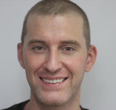Smile Gallery - Church Road Dental and Cosmetic