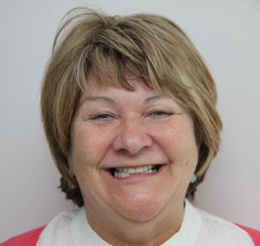 Smile Gallery - Church Road Dental and Cosmetic