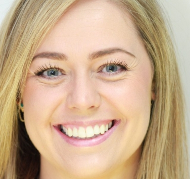 Smile Gallery - Church Road Dental and Cosmetic