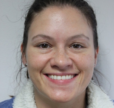 Smile Gallery - Church Road Dental and Cosmetic