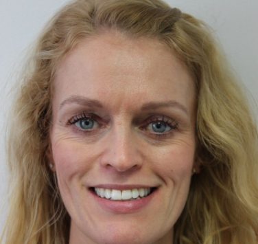 Smile Gallery - Church Road Dental and Cosmetic