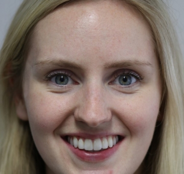 Smile Gallery - Church Road Dental and Cosmetic