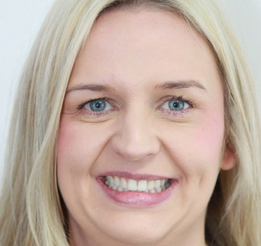 Smile Gallery - Church Road Dental and Cosmetic