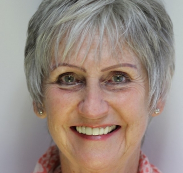 Smile Gallery - Church Road Dental and Cosmetic