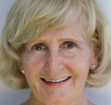 Smile Gallery - Church Road Dental and Cosmetic