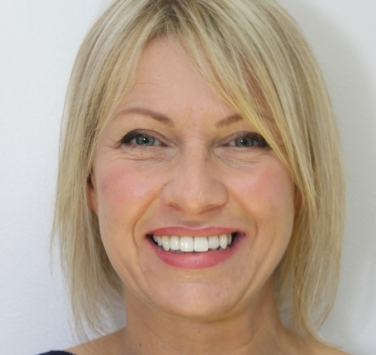 Smile Gallery - Church Road Dental and Cosmetic