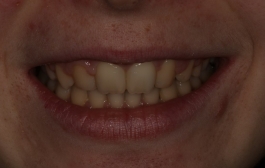 Smile Gallery - Church Road Dental and Cosmetic