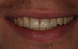 Smile Gallery - Church Road Dental and Cosmetic