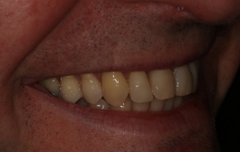 Smile Gallery - Church Road Dental and Cosmetic
