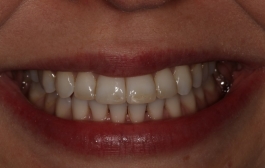 Smile Gallery - Church Road Dental and Cosmetic