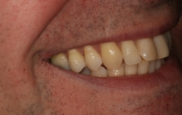 Smile Gallery - Church Road Dental and Cosmetic