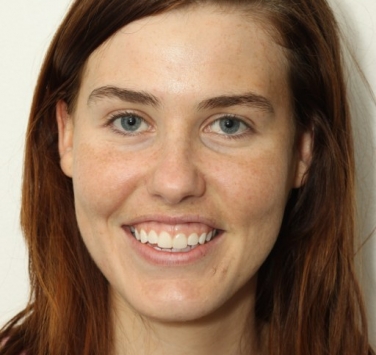 Smile Gallery - Church Road Dental and Cosmetic