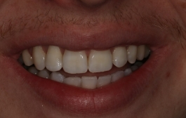 Smile Gallery - Church Road Dental and Cosmetic