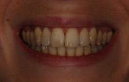 Smile Gallery - Church Road Dental and Cosmetic