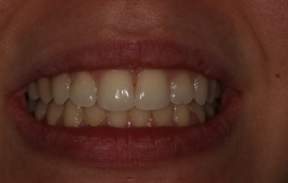 Smile Gallery - Church Road Dental and Cosmetic