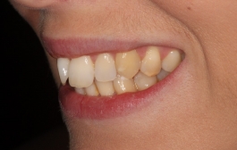 Smile Gallery - Church Road Dental and Cosmetic