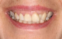 Smile Gallery - Church Road Dental and Cosmetic
