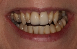 Smile Gallery - Church Road Dental and Cosmetic