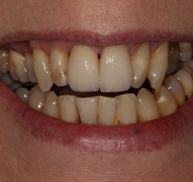 Smile Gallery - Church Road Dental and Cosmetic
