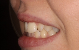 Smile Gallery - Church Road Dental and Cosmetic