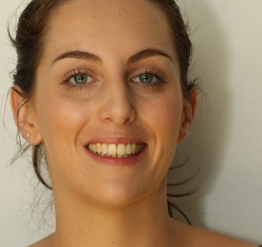 Smile Gallery - Church Road Dental and Cosmetic