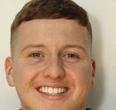 Smile Gallery - Church Road Dental and Cosmetic