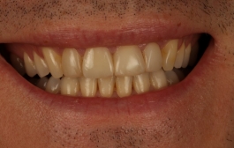 Smile Gallery - Church Road Dental and Cosmetic