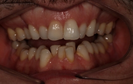 Smile Gallery - Church Road Dental and Cosmetic