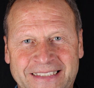 Smile Gallery - Church Road Dental and Cosmetic
