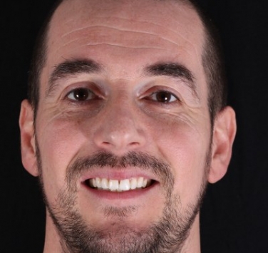 Smile Gallery - Church Road Dental and Cosmetic