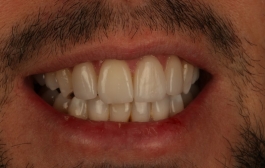 Smile Gallery - Church Road Dental and Cosmetic