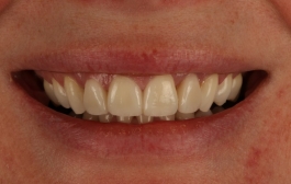 Smile Gallery - Church Road Dental and Cosmetic