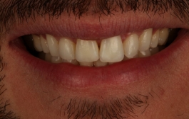 Smile Gallery - Church Road Dental and Cosmetic
