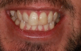 Smile Gallery - Church Road Dental and Cosmetic
