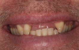 Smile Gallery - Church Road Dental and Cosmetic
