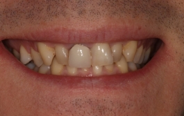 Smile Gallery - Church Road Dental and Cosmetic