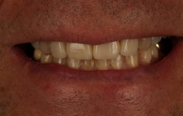 Smile Gallery - Church Road Dental and Cosmetic