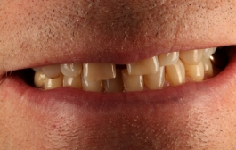 Smile Gallery - Church Road Dental and Cosmetic