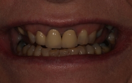 Smile Gallery - Church Road Dental and Cosmetic
