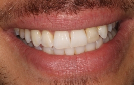 Smile Gallery - Church Road Dental and Cosmetic