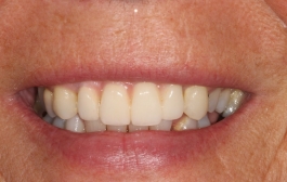 Smile Gallery - Church Road Dental and Cosmetic
