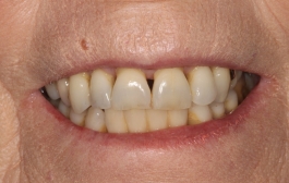 Smile Gallery - Church Road Dental and Cosmetic