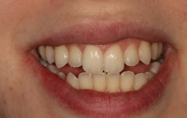 Smile Gallery - Church Road Dental and Cosmetic