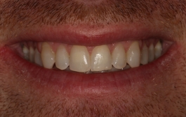 Smile Gallery - Church Road Dental and Cosmetic