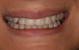 Smile Gallery - Church Road Dental and Cosmetic
