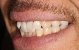 Smile Gallery - Church Road Dental and Cosmetic