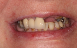 Smile Gallery - Church Road Dental and Cosmetic