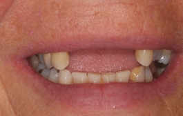 Smile Gallery - Church Road Dental and Cosmetic