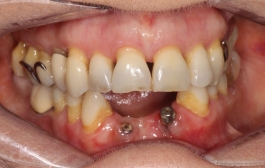 Smile Gallery - Church Road Dental and Cosmetic