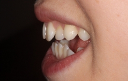 Smile Gallery - Church Road Dental and Cosmetic